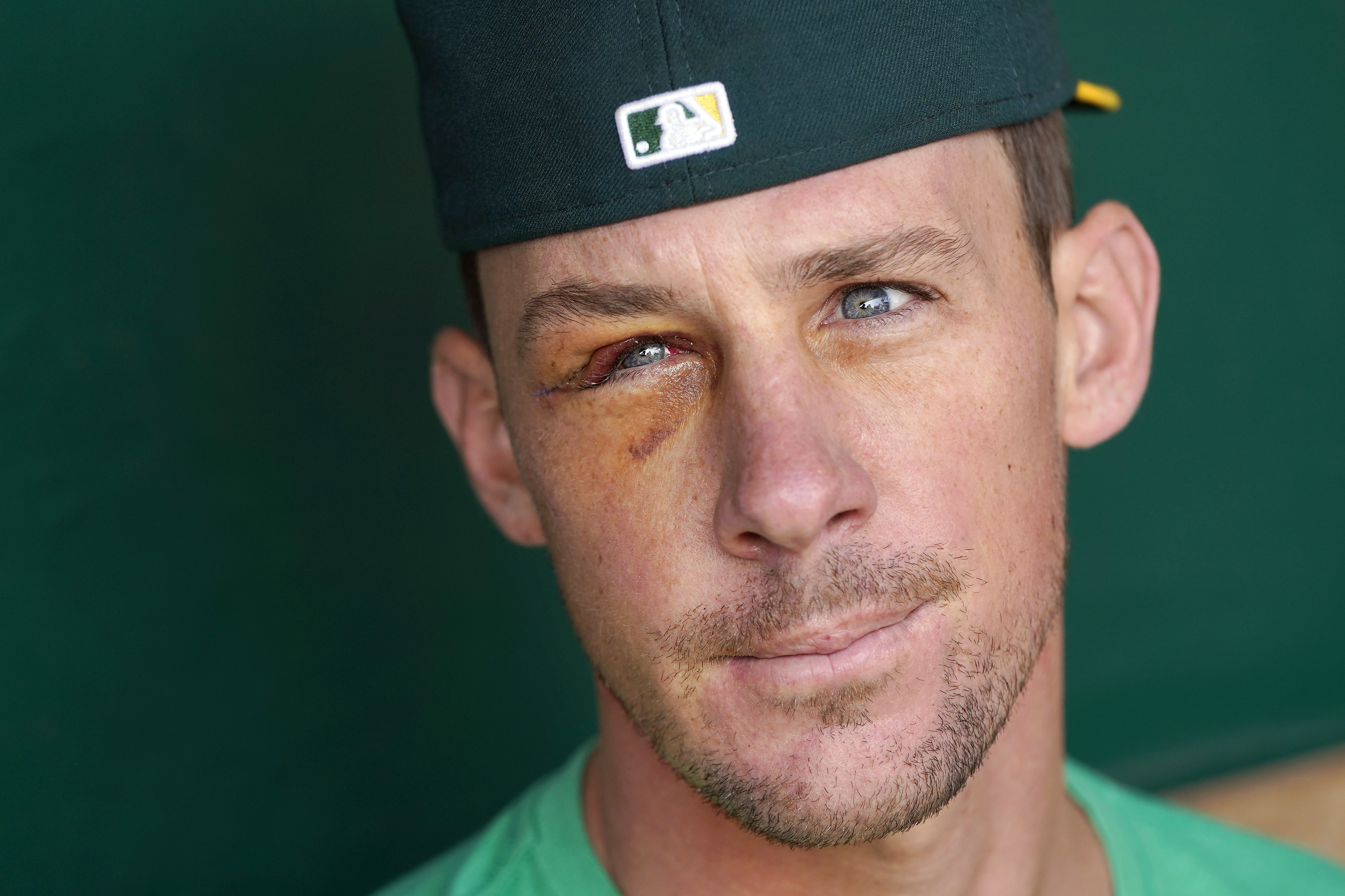 MLB star Chris Bassitt stretchered off and rushed to hospital and