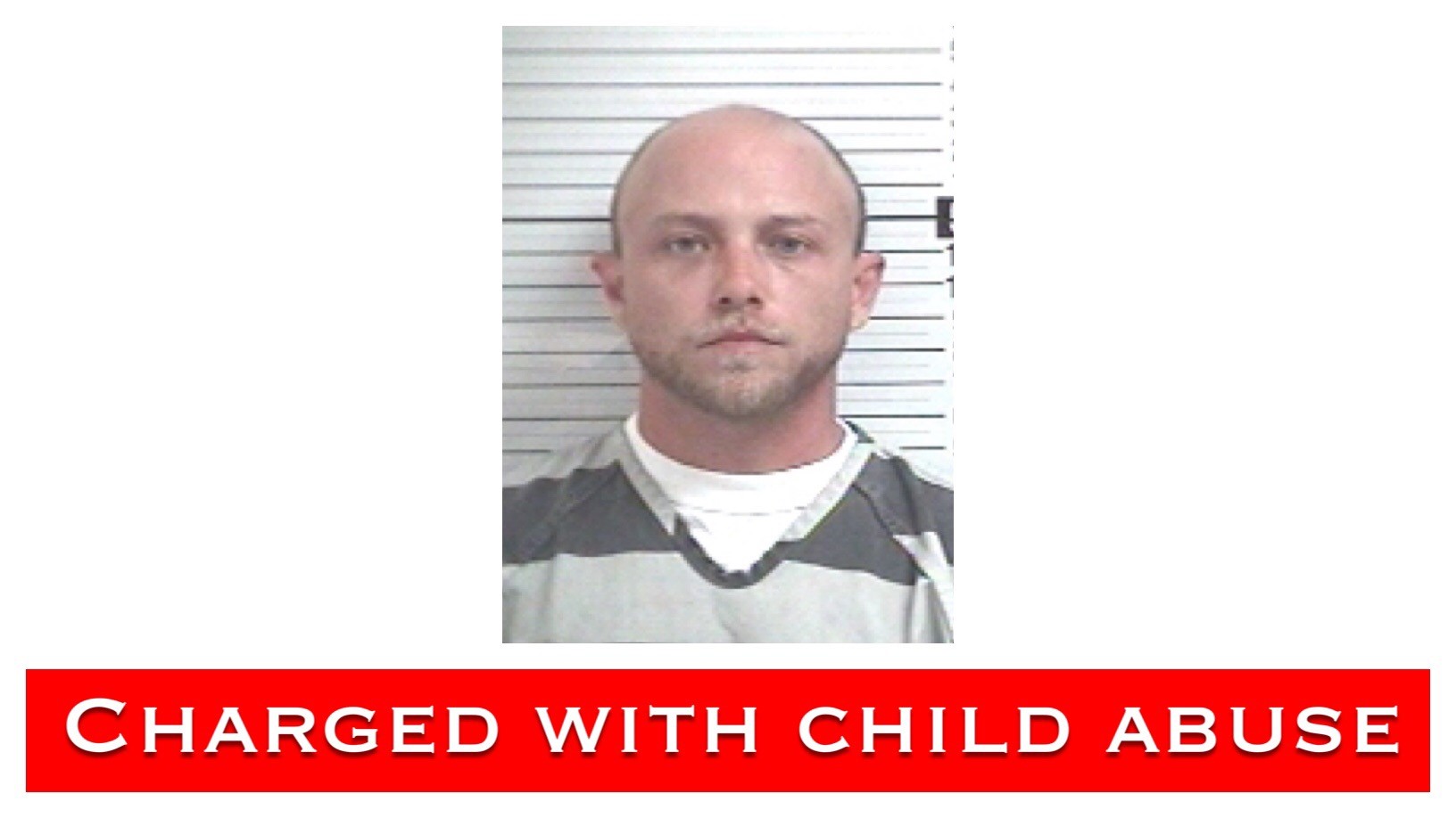 Teacher accused of child abuse