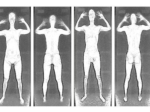 With Modesty In Mind, TSA Rolls Out New Body Scans : NPR