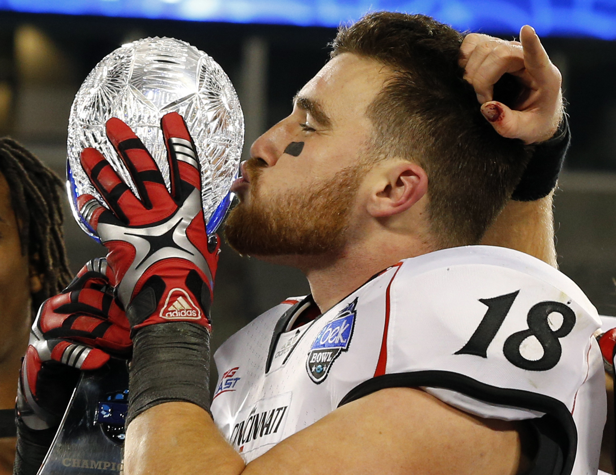 WATCH: Former UC Bearcats Jason, Travis Kelce square off in Super