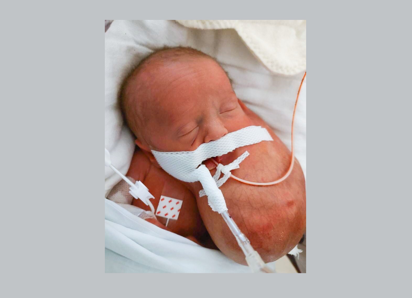 健康・医学 UROLOGIC SURGERY in Infants and Children Pediatric Surgery (Springer Surgery Atlas Series
