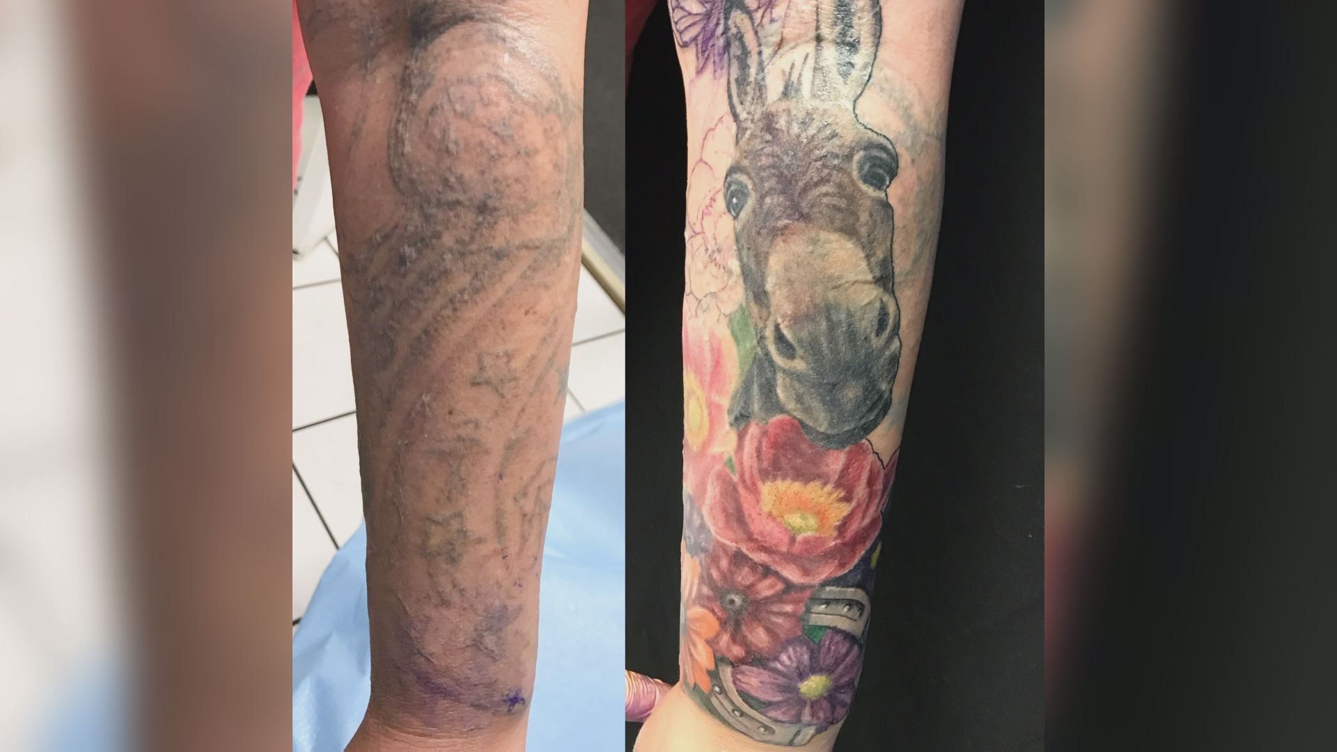 Self scars over tattoo harm Tattoo artist