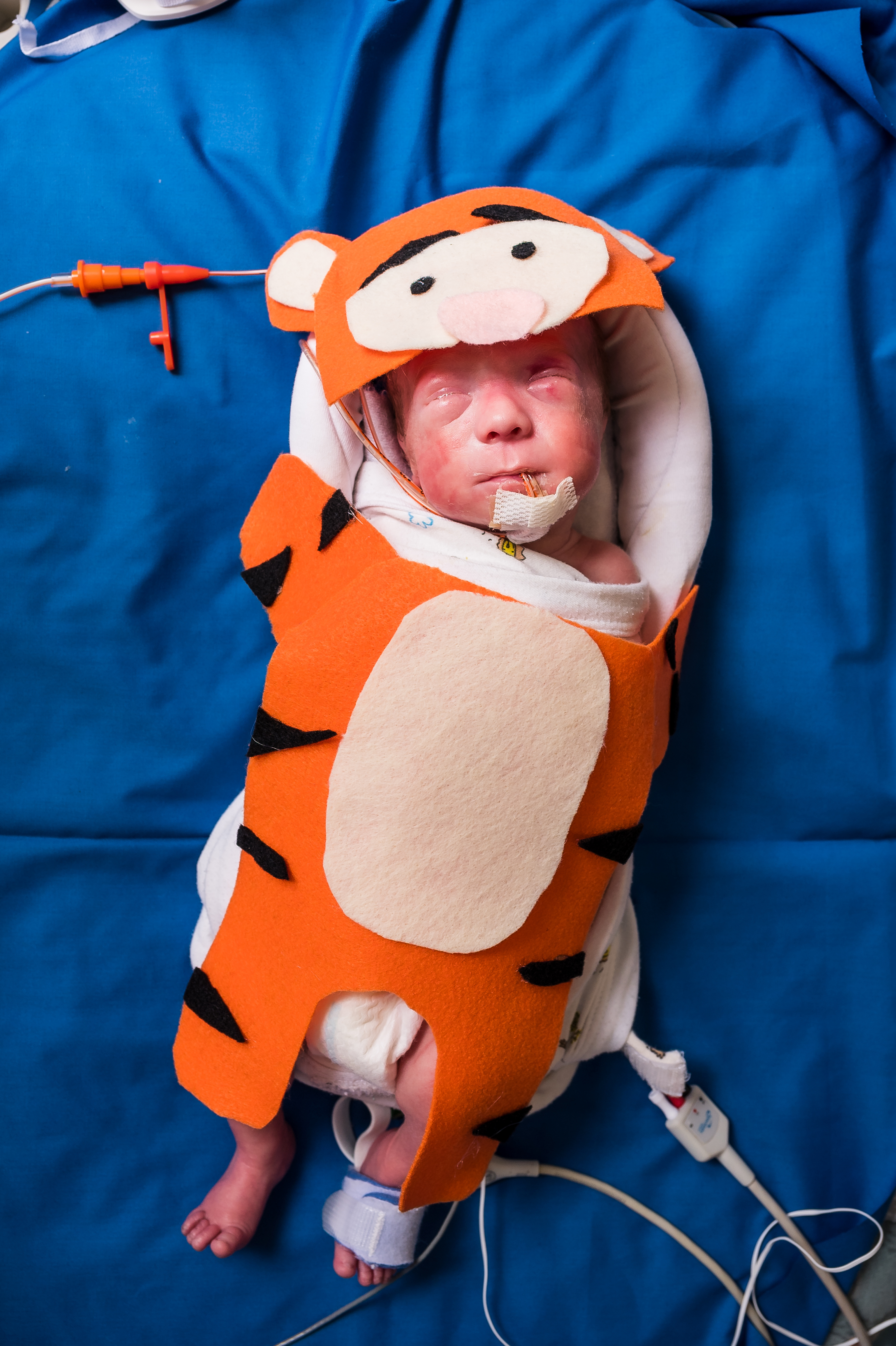 Photos: UofL Health NICU babies dress up in Halloween costumes