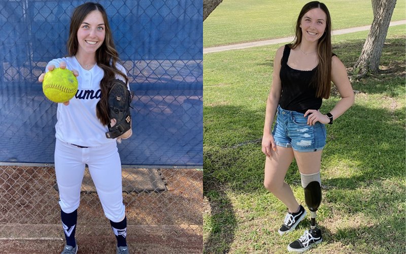 Amputee White Sox Fan Catches Ball with Prosthetic Leg