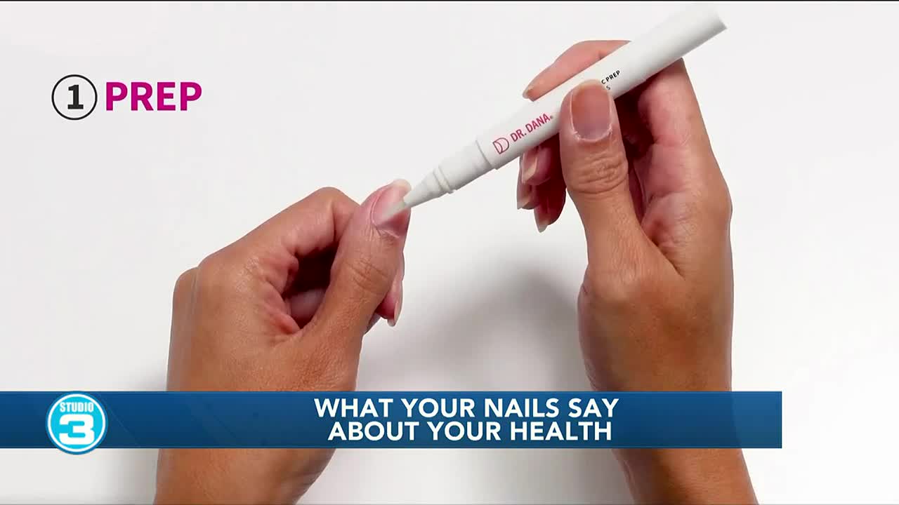 Slideshow: What Your Nails Say About Your Health | Retiree News
