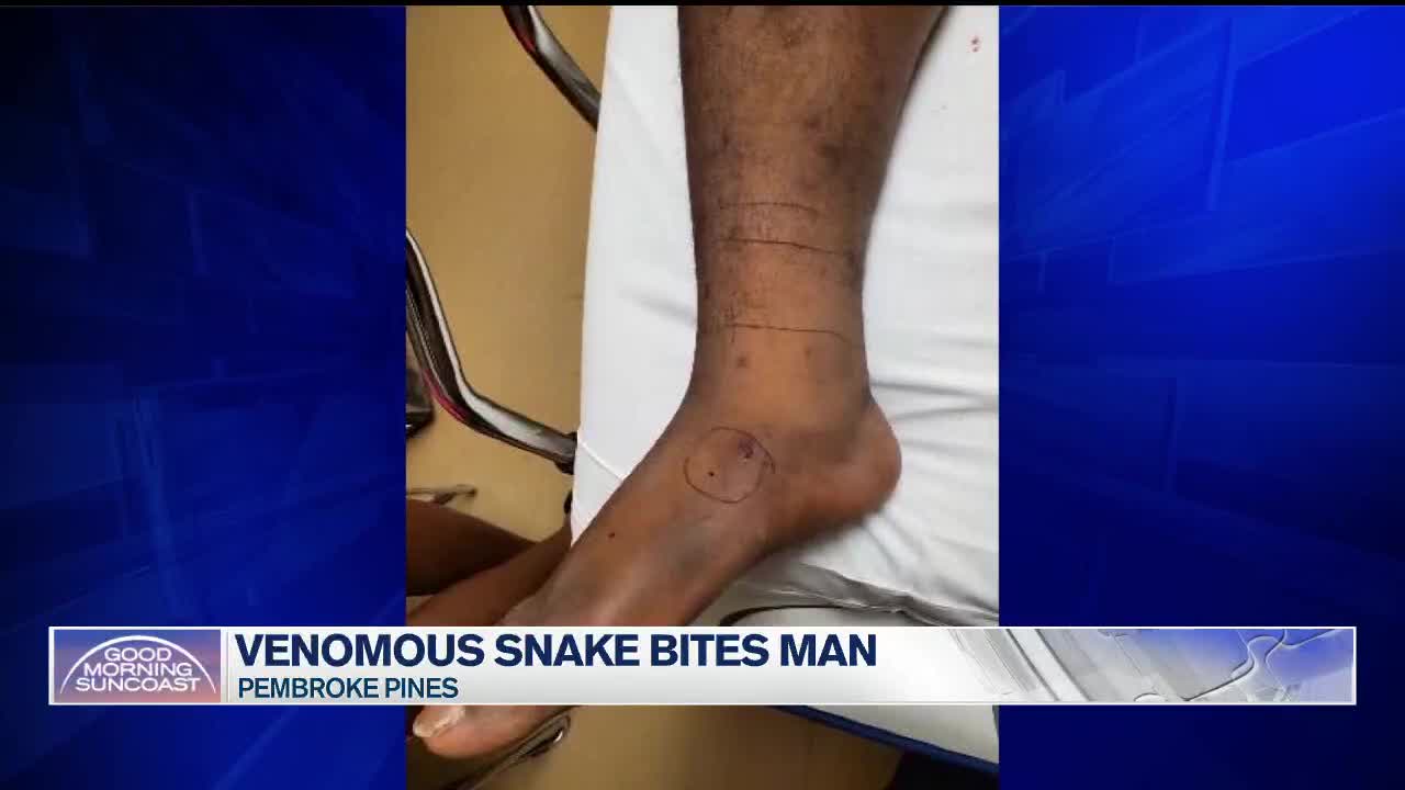 poisonous snake bites