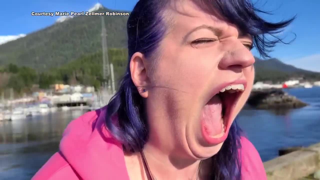 It's official! She has a big mouth