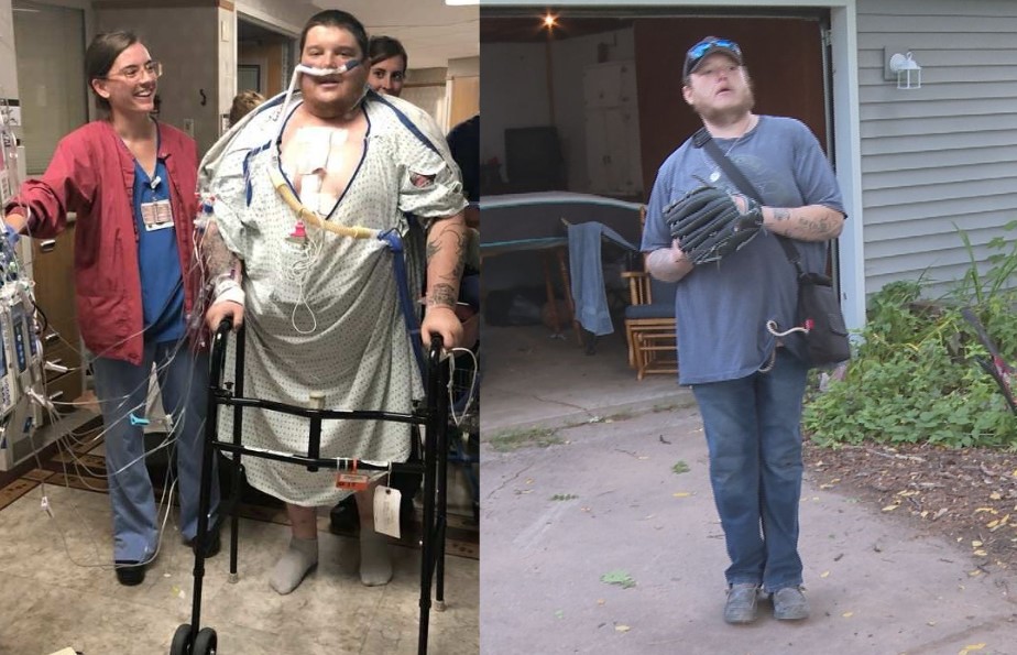 glp-1 weight loss milwaukee Man loses 200 pounds from GLP-1 weight loss injections
