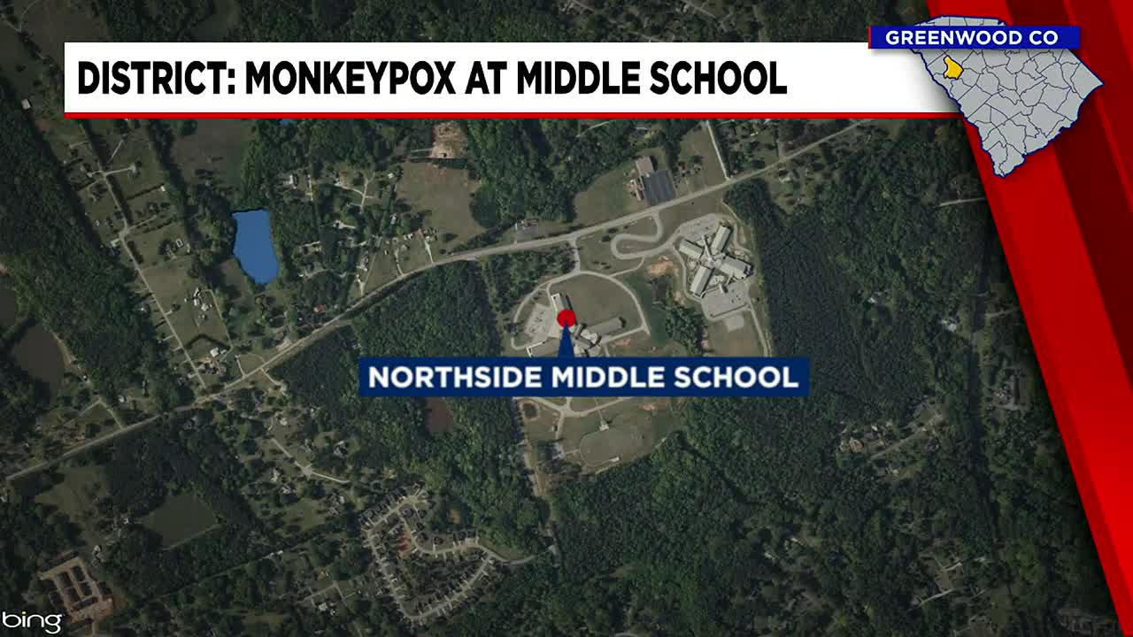 District responds to potential case of monkey pox at school