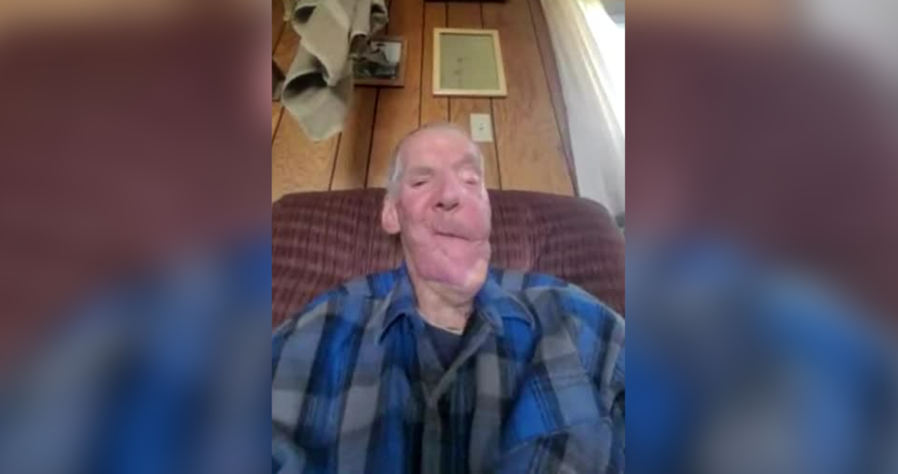 Former Nome fire chief scarred by bear mauling offers comfort to other  attack victims, image size:1280x676