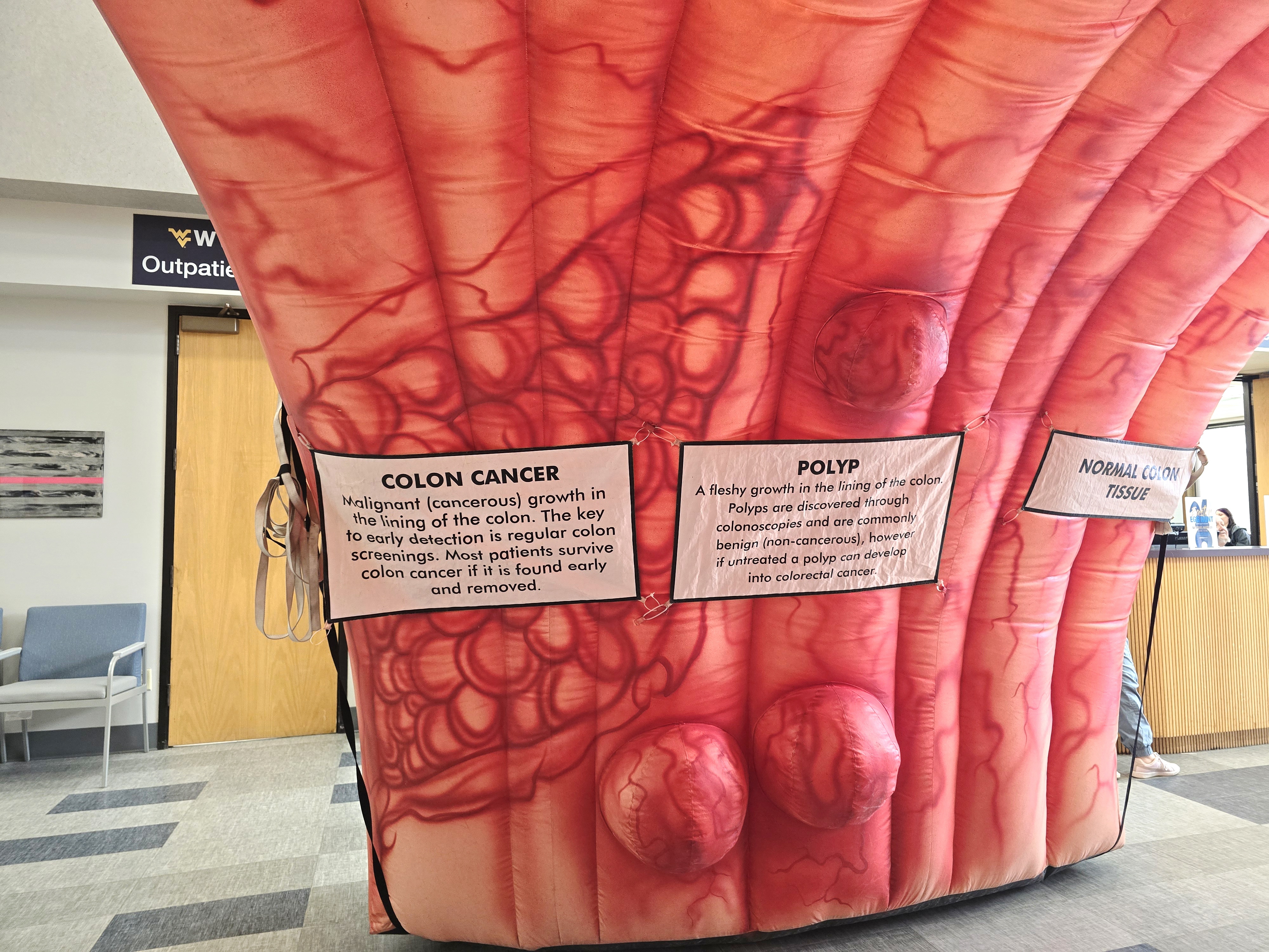 Giant colon exhibit highlights cancer screenings at WVU Medicine