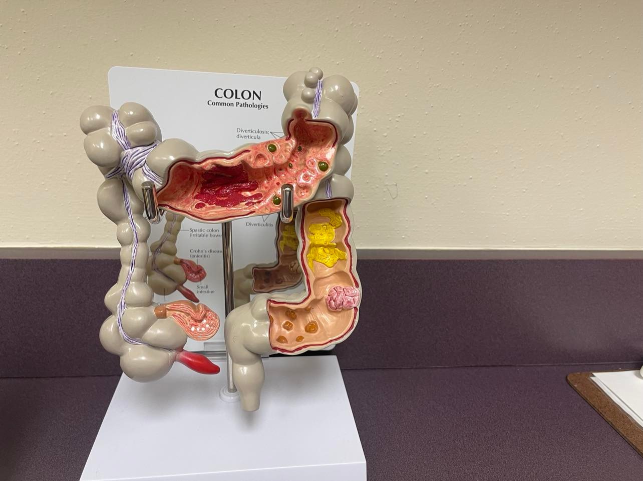Panhandle seeing increasing rate of colorectal cancer cases in