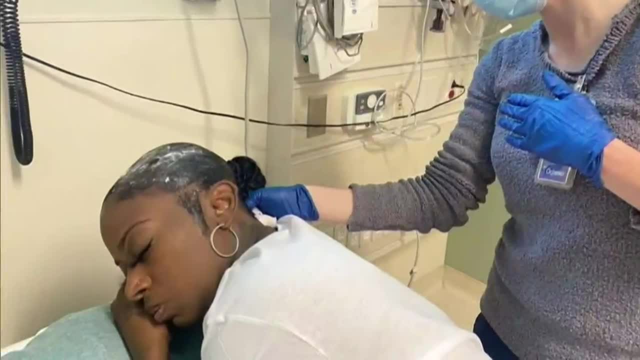 Woman recovers after doctor removes Gorilla Glue from hair