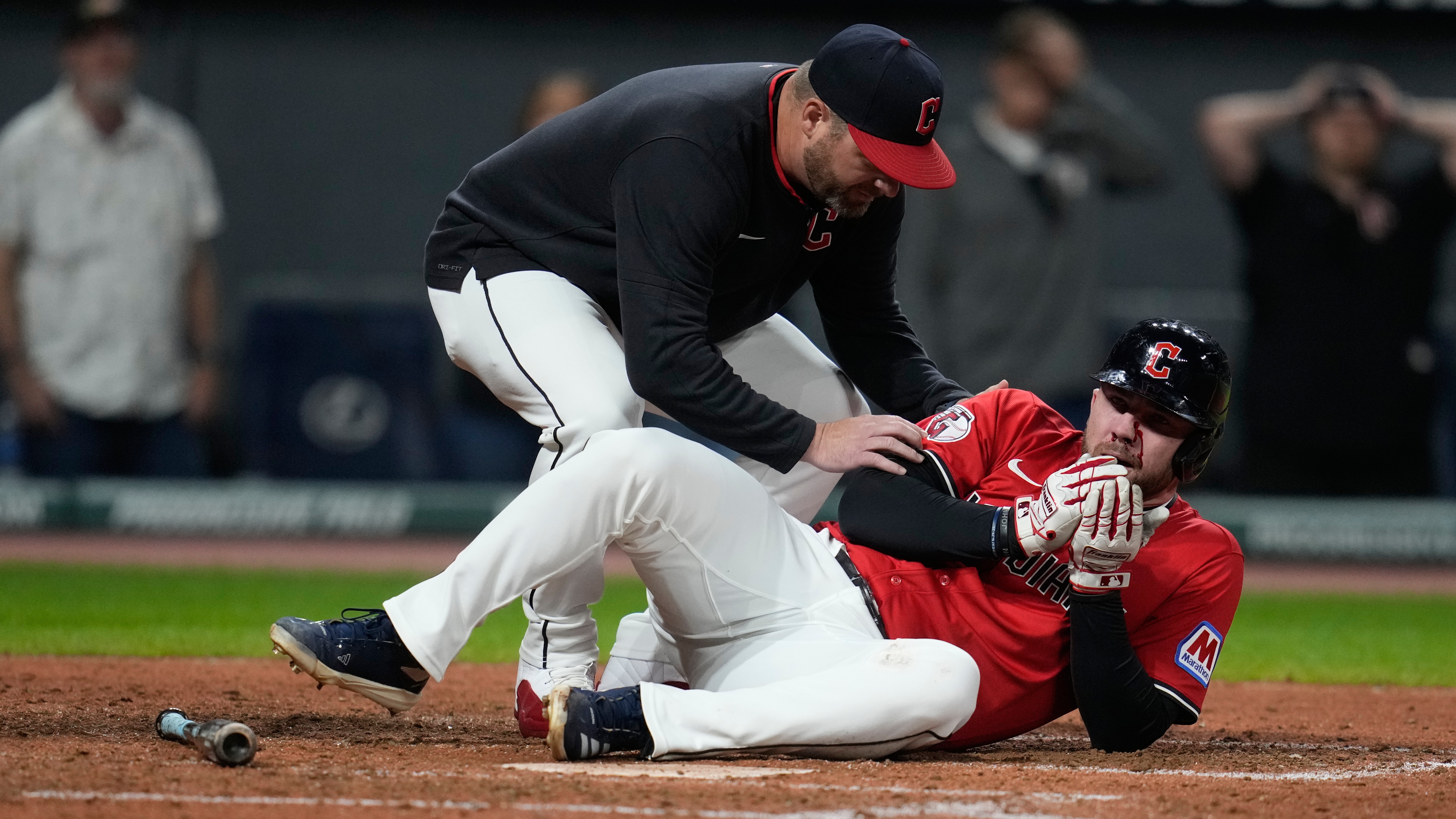 Guardians’ David Fry hospitalized after being hit in face by pitch during  crucial win over Tigers