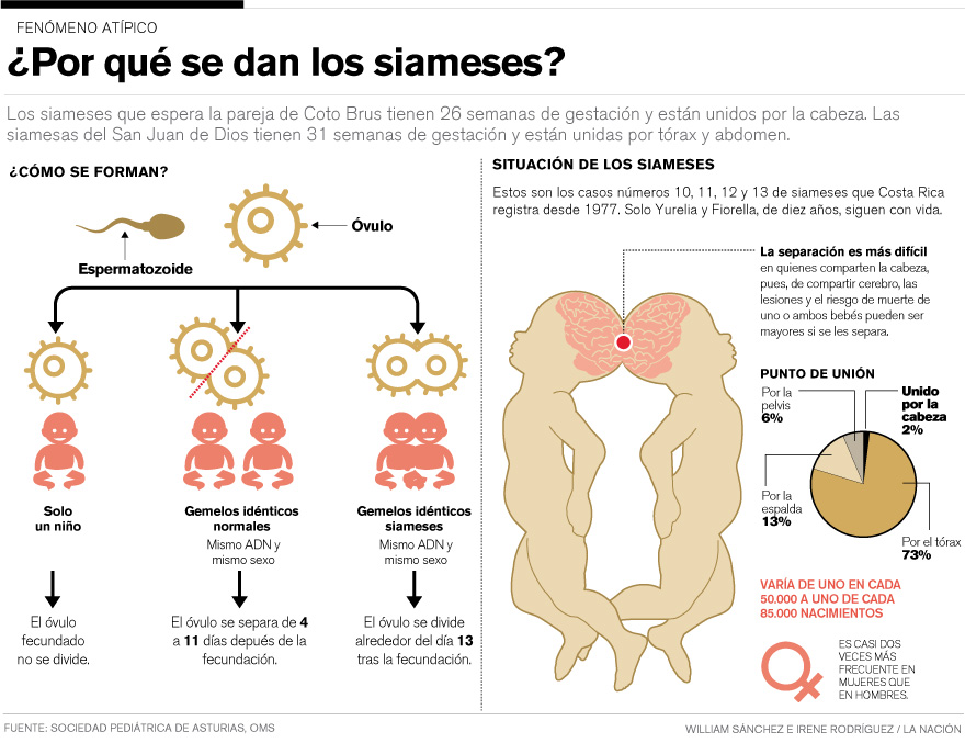 ¿Por qué se dan los siameses?