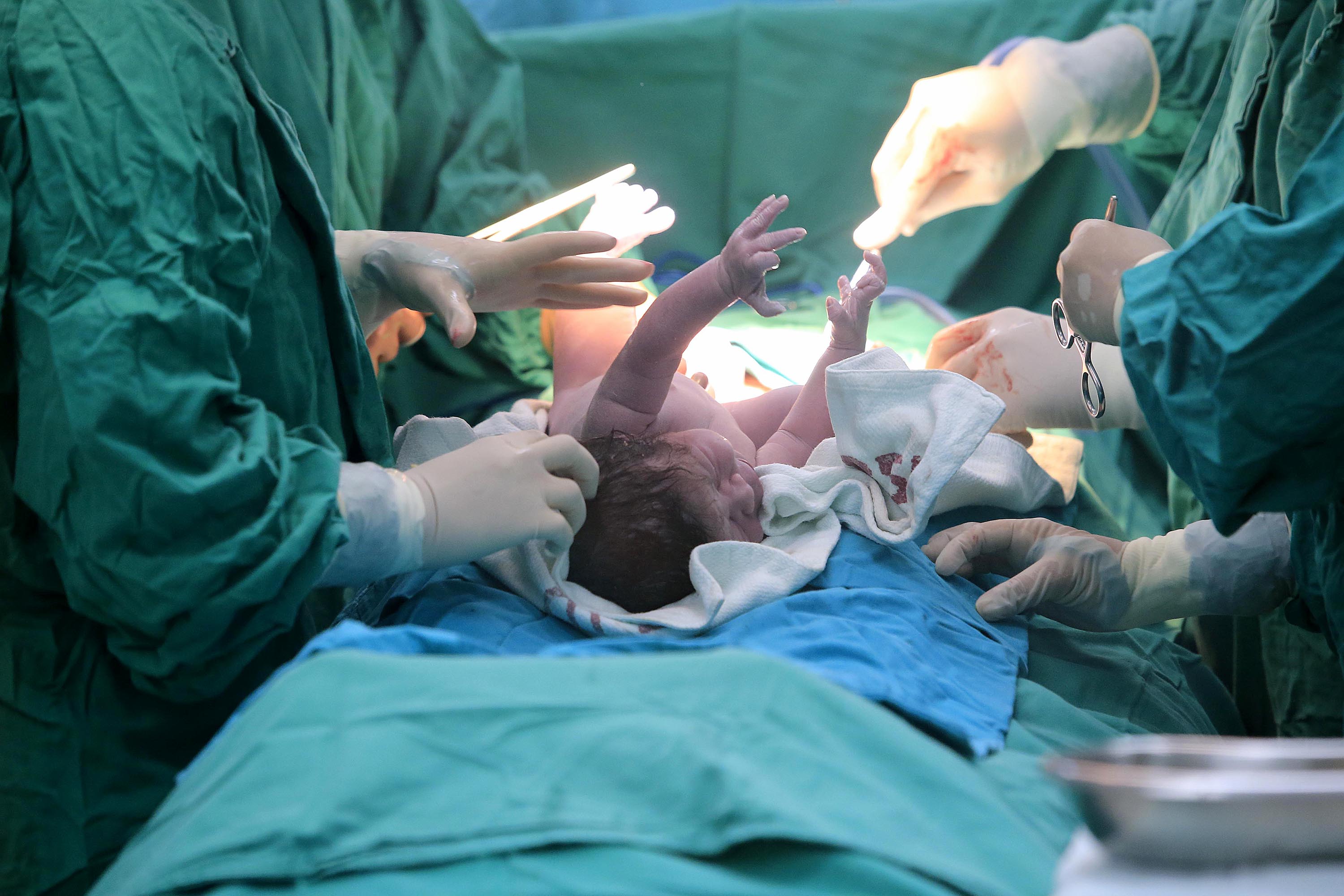 01/09/2018 Hospital San Vicente de Paúl, Heredia. Nacimiento del tico 5 millones símbolo, quien según cálculos del Instituto Nacional de Estadística y Censos (INEC), nacería en algún lugar del país después de las 9:27 p.m. El niño Ethan Jesús, nació por cesárea, a las 9:27p.m. y es el primer hijo de Madeline Alvarado Calvo, de 27 años, y Reinier Brenes Calvo, de 31 años. El doctor, Násser Alrashdan Bejarano, y lo asistió Roberto Brenes Esquivel. Foto: Rafael Pacheco