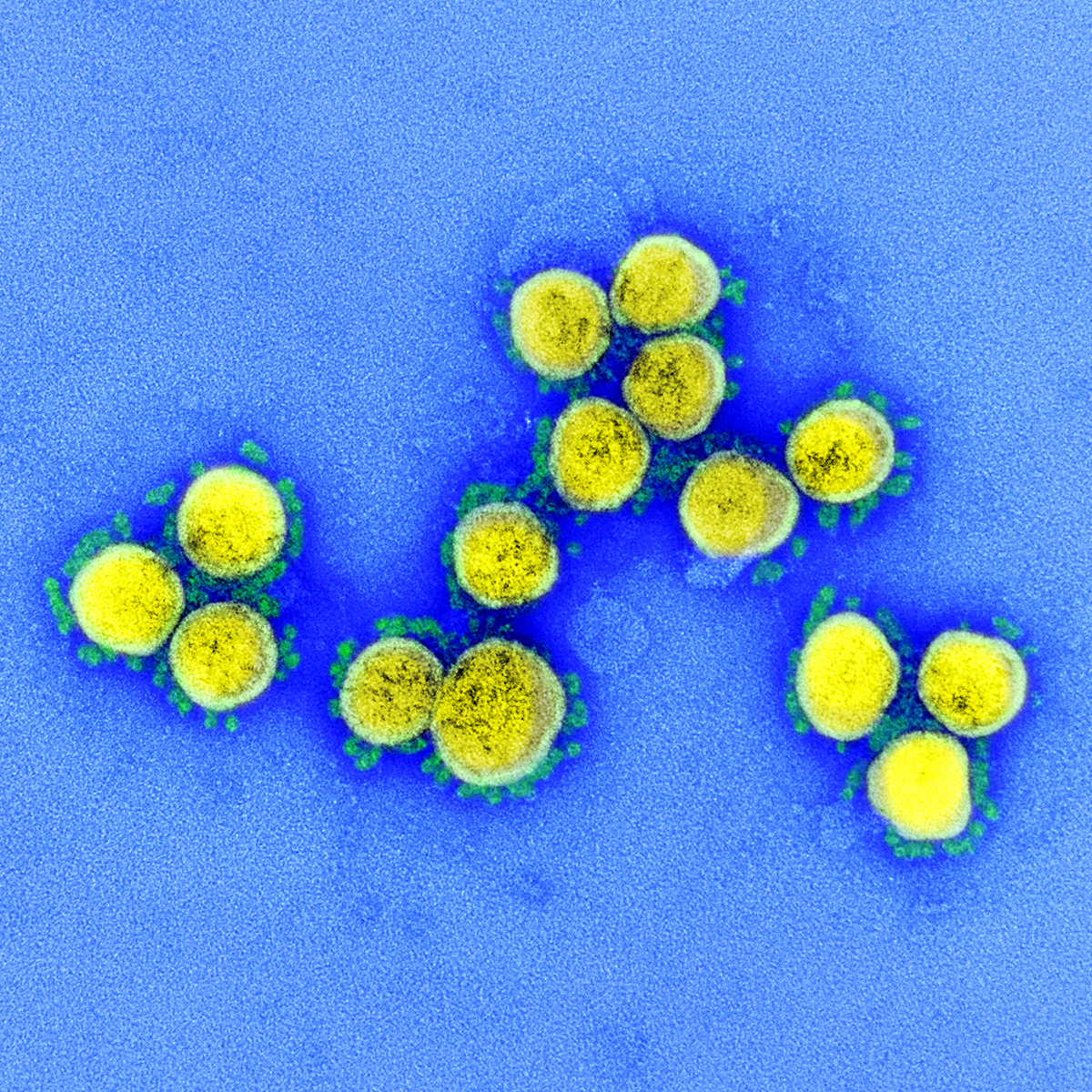 Estas son partículas del SARS-CoV-2, virus causante de la covid-19, aisladas de un paciente y puestas en un microscopio electrónico.
Fotografía: NIAID
