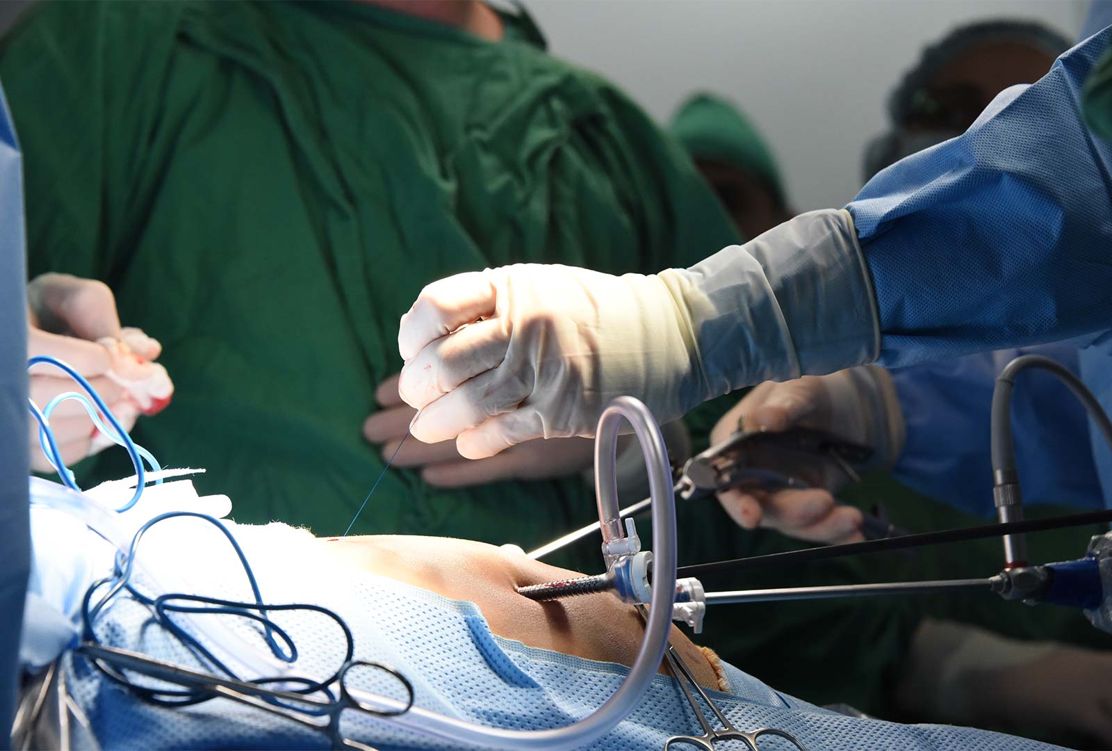 Doctor chileno operó cuatro brumositos con moderna técnica. Mediante una novedosa técnica de las manos del experimentado médico chileno, Miguel Guelfand, especialista en cirugía infantil y neonatal,quirúrgica.