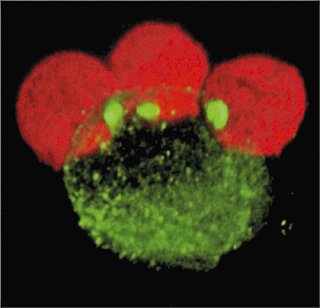 Sida. La célula infectada por el VIH (verde), se une y contagia mediante sinapsis, células sanas (rojas). Foto Science para La Nación