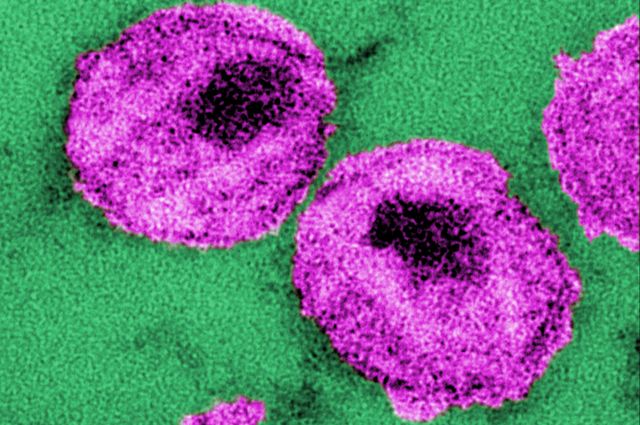 La investigación consiste en enviar un agente a "despertar" el virus dominante. Esto hace que se comience a replicar y entonces, el sistema inmunitario o el virus matan a la célula con VIH.