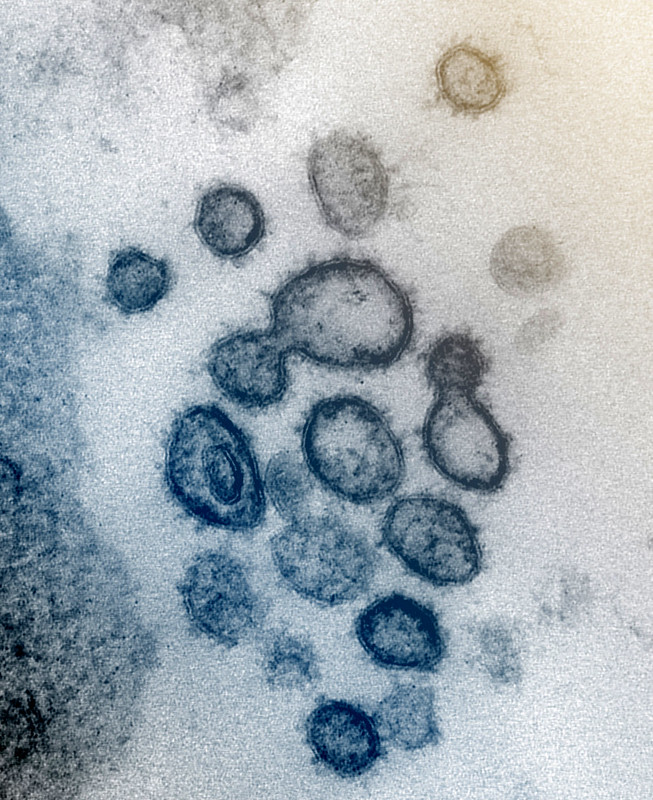 Así se ve el nuevo coronavirus, causante del covid-19 en un microscopio, Este virus de la imagen fue aislado de un paciente estadounidense.
Fotografía: NIAID-RML