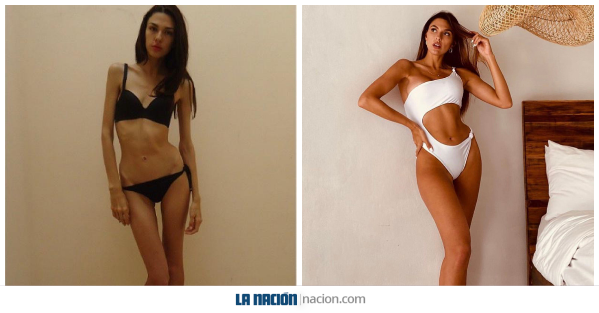Valeria compartió la imagen de la izquierda mostrando el estado al que la llevó la anorexia. En la imagen de la derecha se ve su figura actual que mantiene gracias a alimentación balanceada y ejercicio. Fotos: Valeria Rees para LN