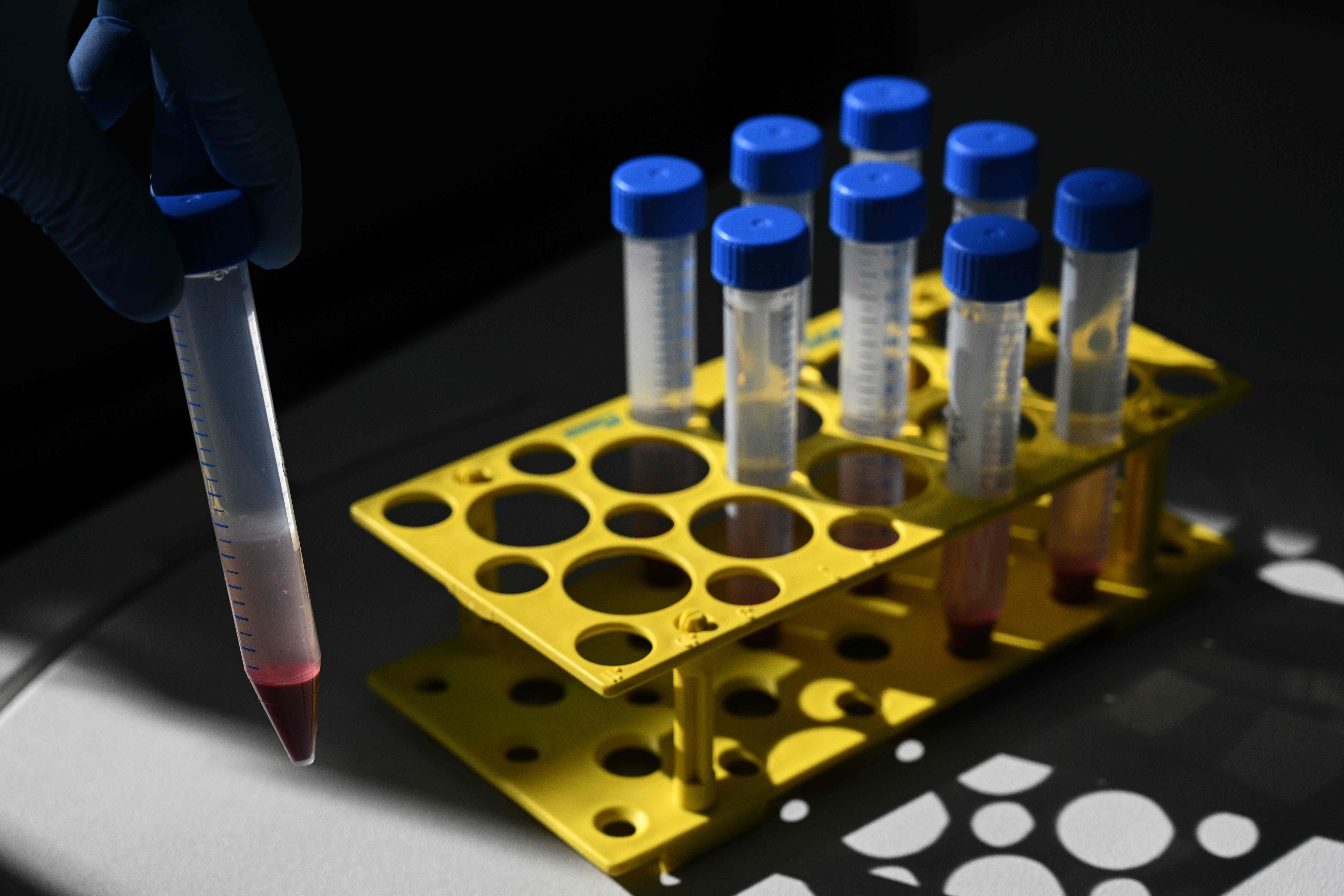 Argentine Dr. Gisela Marcoppido, veterinary researcher of the INTA (National Agricultural Technology Institute) and CONICET (National Scientific and Technical Research Council) displays the mononuclear cell purification from peripheral blood samples obtained from llamas immunized with SARS CoV 2 protein at INCUINTA laboratory at INTA Castelar in Hurlingham, Buenos Aires, Argentina, on June 2, 2020. - "My whole life is a virus," summarizes Argentine researcher Viviana Parreno, leader of a scientific team that has found a way to neutralize them using nano-antibodies 'grown' in llamas, an experience that now seeks to be the key to fighting covid-19. (Photo by JUAN MABROMATA / AFP)