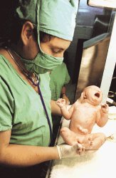 Al nacer, los bebés pierden todo vínculo con la placenta que los alimentaba. Cambio. |
ARCHIVO /LA NACIÓN