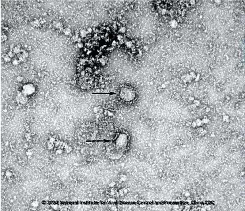 28/01/2020 Esta es la primera imagen revleada al público de cómo se ve este patógeno. Fotografía: Centro de Control de Enfermedades de China / Coronavirus