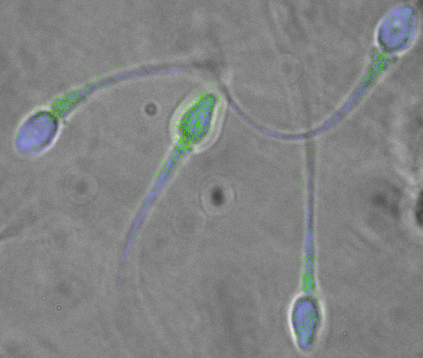 Científicos chinos desarrollaron un método para reproducir la formación de células de esperma que sean viables mediante la técnica in vitro.