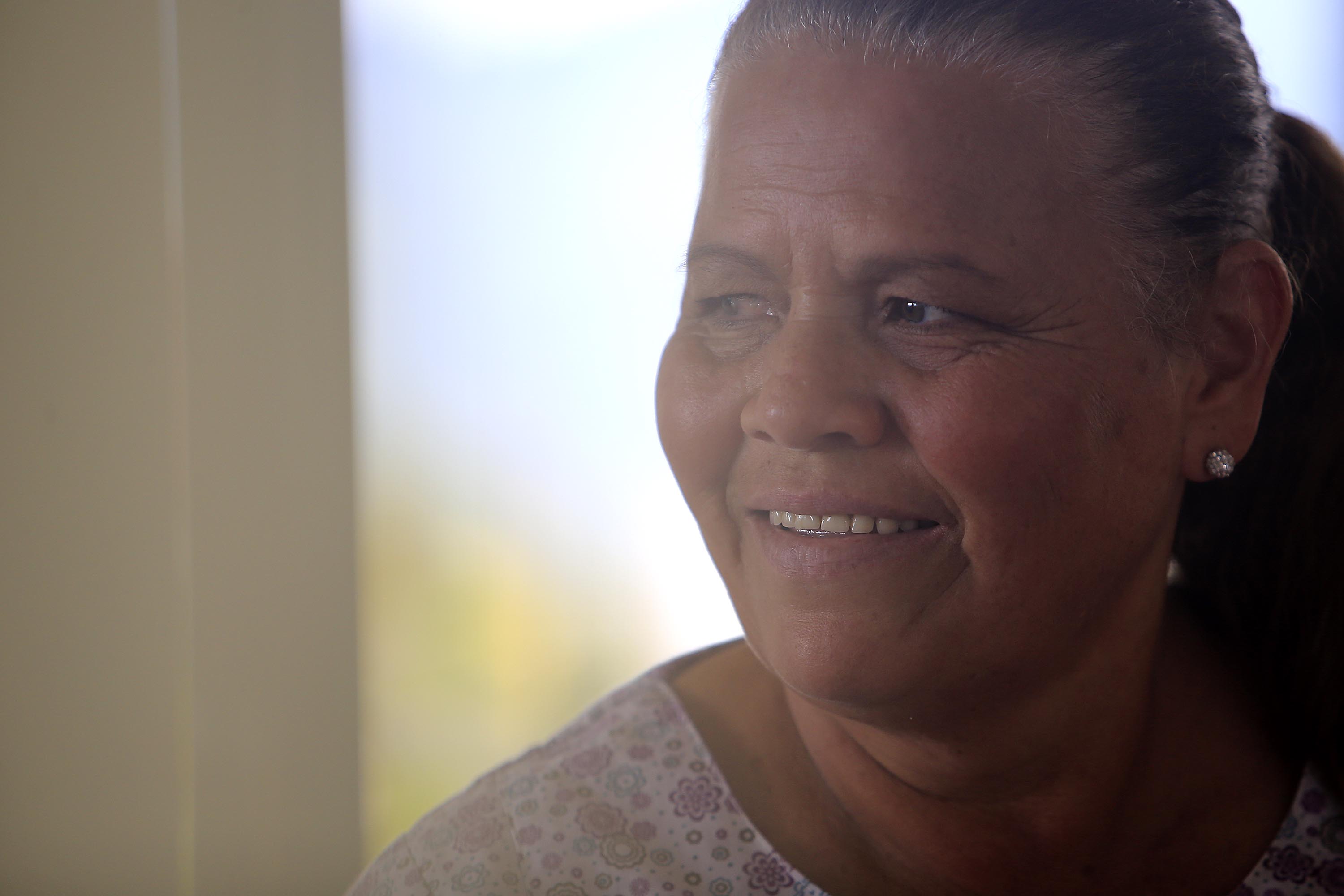 “Casi no podía ver. Me enchilaba mucho la luz, aparte de que se me veía horrible, como rojo vivo. Sentía piedras en el ojo y me lloraba a cada rato”, relata María Lidia Morales. Rafael Pacheco