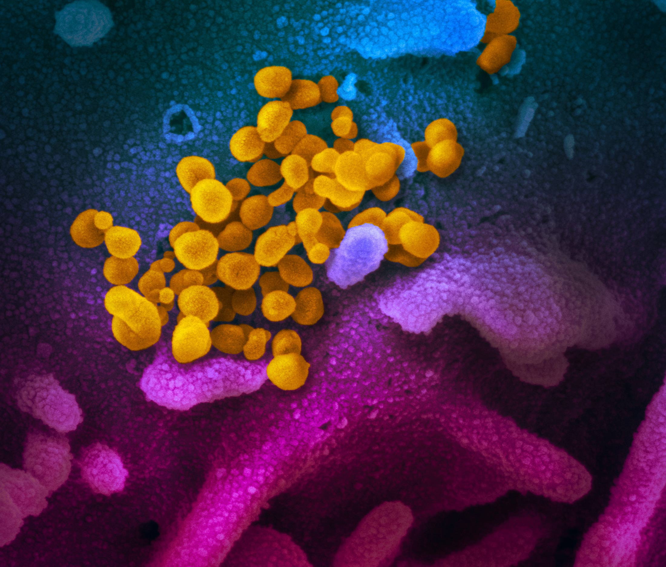 This scanning electron microscope image shows SARS-CoV-2 (yellow)—also known as 2019-nCoV, the virus that causes COVID-19—isolated from a patient in the U.S., emerging from the surface of cells (blue/pink) cultured in the lab.
Credit: NIAID-RML
