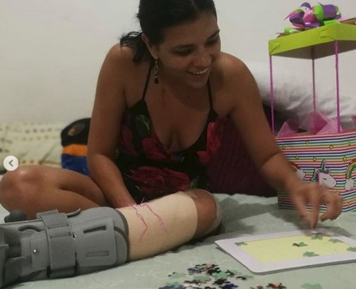 Natalia Rodríguez permanecerá cuatro semanas incapacitada. Foto: Natalia Carvajal para LN