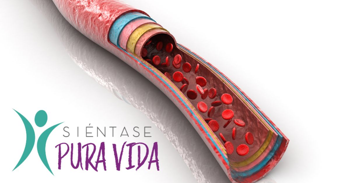 Años de los malos hábitos pueden llevar a formar placas en las arterias y esto dificulta el paso de la sangre.
Imagen: Shutterstock