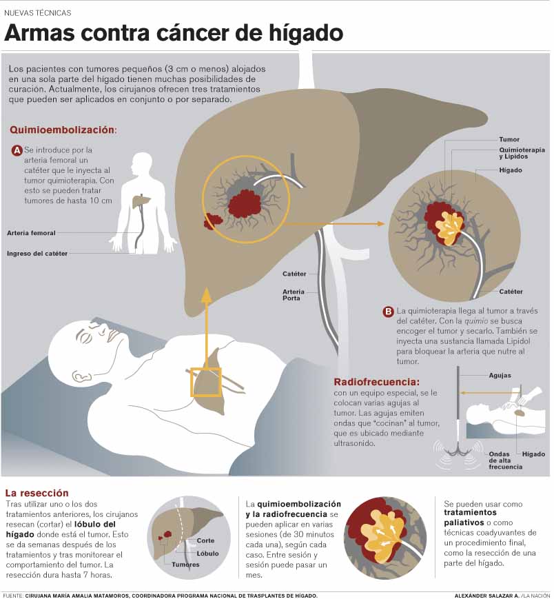 | /LA NACIÓN