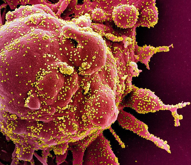 This handout image obtained on April 29, 2020 and released by the National Institute of Allergy and Infectious Diseases (NIAID) of the National Institutes of Health (NIH), shows a colorized scanning electron micrograph of an apoptotic cell (red) heavily infected with SARS-COV-2 virus particles (yellow), isolated from a patient sample captured at the NIAID Integrated Research Facility (IRF) in Fort Detrick, Maryland. - The US intelligence community said Thursday it had concluded that the novel coronavirus that has swept the globe originated in China but was not man-made or engineered. (Photo by Handout / National Institute of Allergy and Infectious Diseases / AFP) / RESTRICTED TO EDITORIAL USE - MANDATORY CREDIT "AFP PHOTO / NATIONAL INSTITUTE OF ALLERGY AND INFECTIOUS DISEASES, NIH " - NO MARKETING - NO ADVERTISING CAMPAIGNS - DISTRIBUTED AS A SERVICE TO CLIENTS