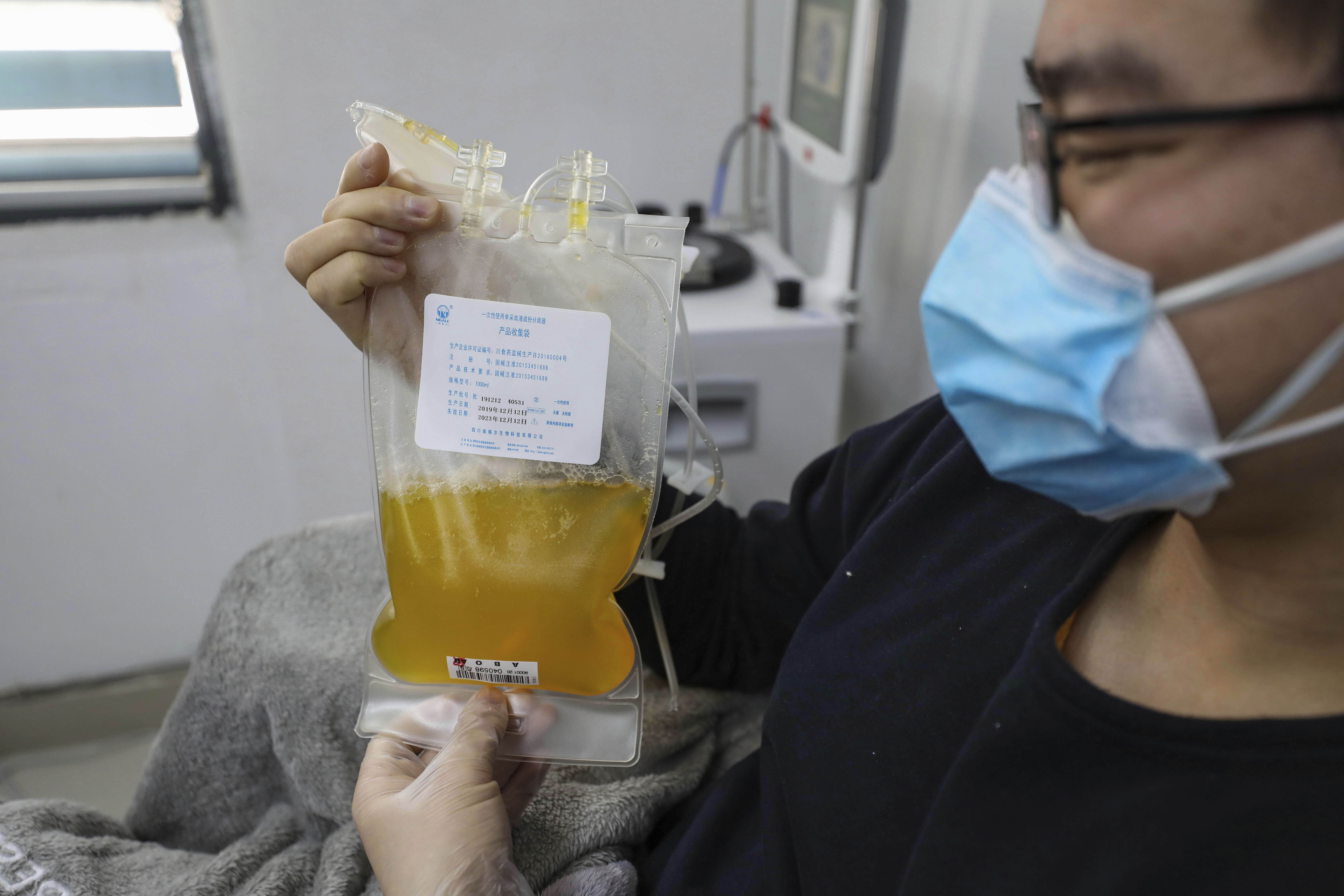 Dr. Zhou Min, a recovered COVID-19 patient who has passed his 14-day quarantine, donates plasma in the city's blood center in Wuhan in central China's Hubei province Tuesday, Feb. 18, 2020. Plasma from recovered COVID-19 patients contains antibodies that can help reduce the virus load in critically ill patients, according to China's National Health Commission.(Chinatopix via AP)