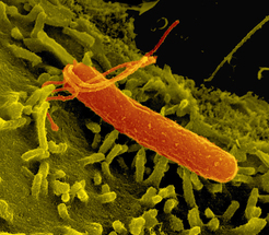 La bacteria Helicobacter pylori está relacionada con el cáncer gástrico.