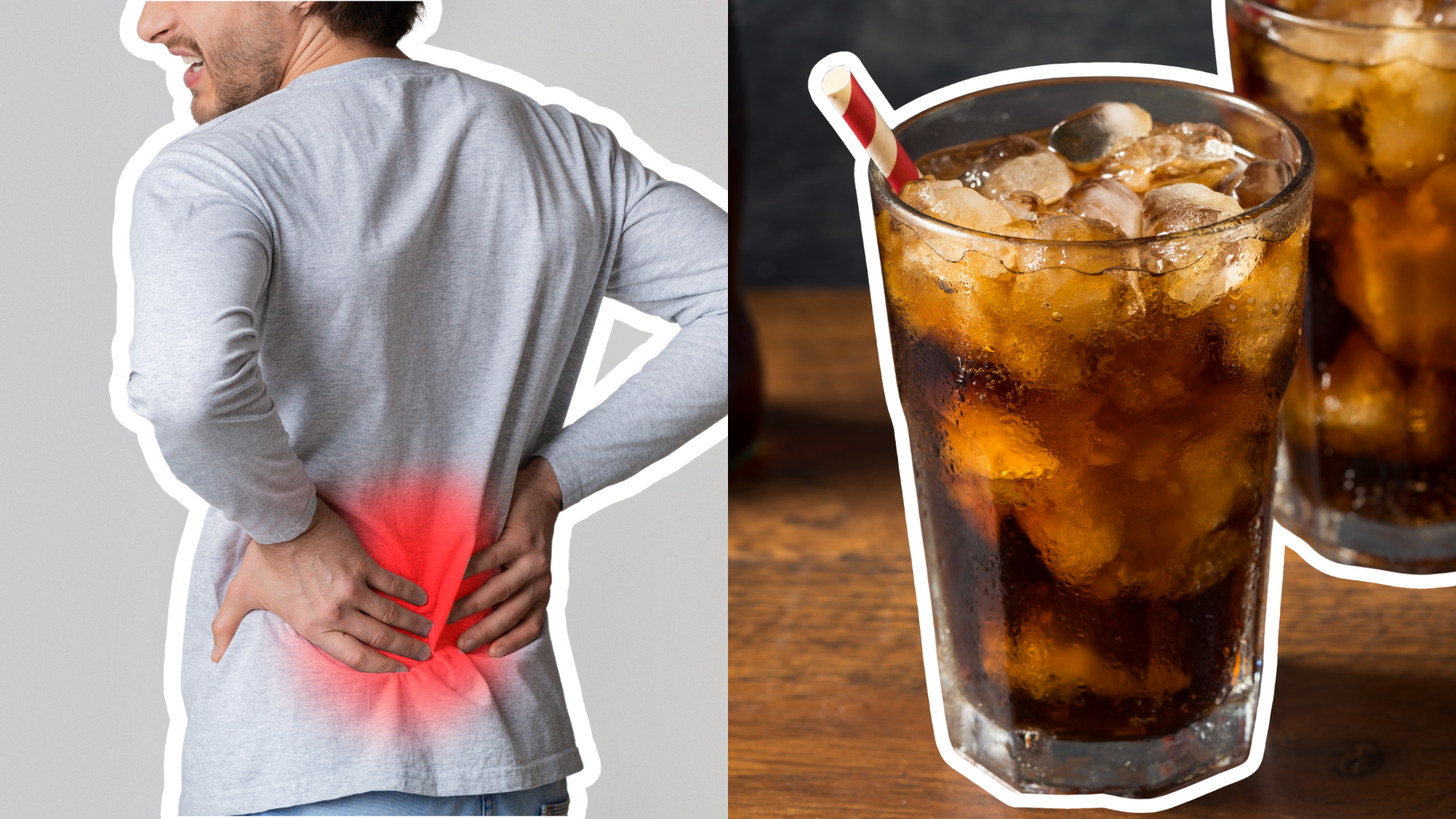 El consumo frecuente de bebidas oscuras, como café y gaseosas, aumenta la presencia de oxalato en la orina y eleva el riesgo de formación de cálculos renales.