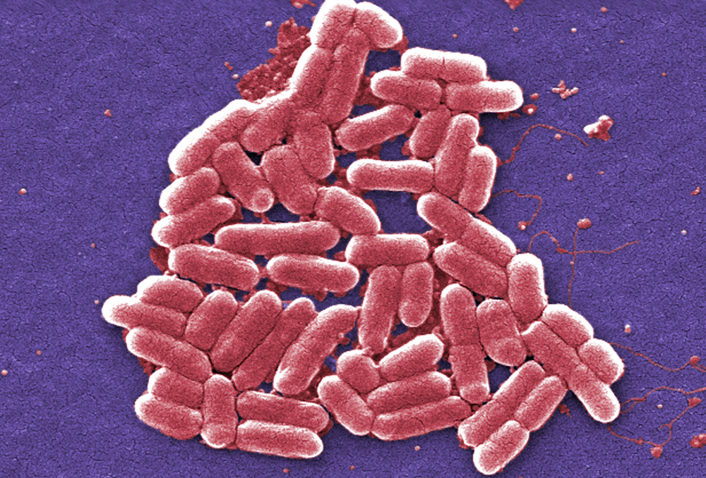 La Esterichia coli es de las bacterias más comunes en infecciones en humanos, también es una de las que más resistencia a medicamentos genera. | ARCHIVO