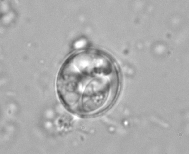 Así se ve el parásito Eimeria caliginosa en el microscopio. | UCIMED PARA LN