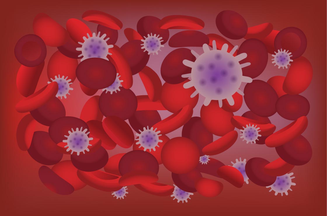 La septicemia comienza como una infección en la sangre que, una vez en el torrente puede afectar diferentes órganos.
Ilulstración: Shutterstock