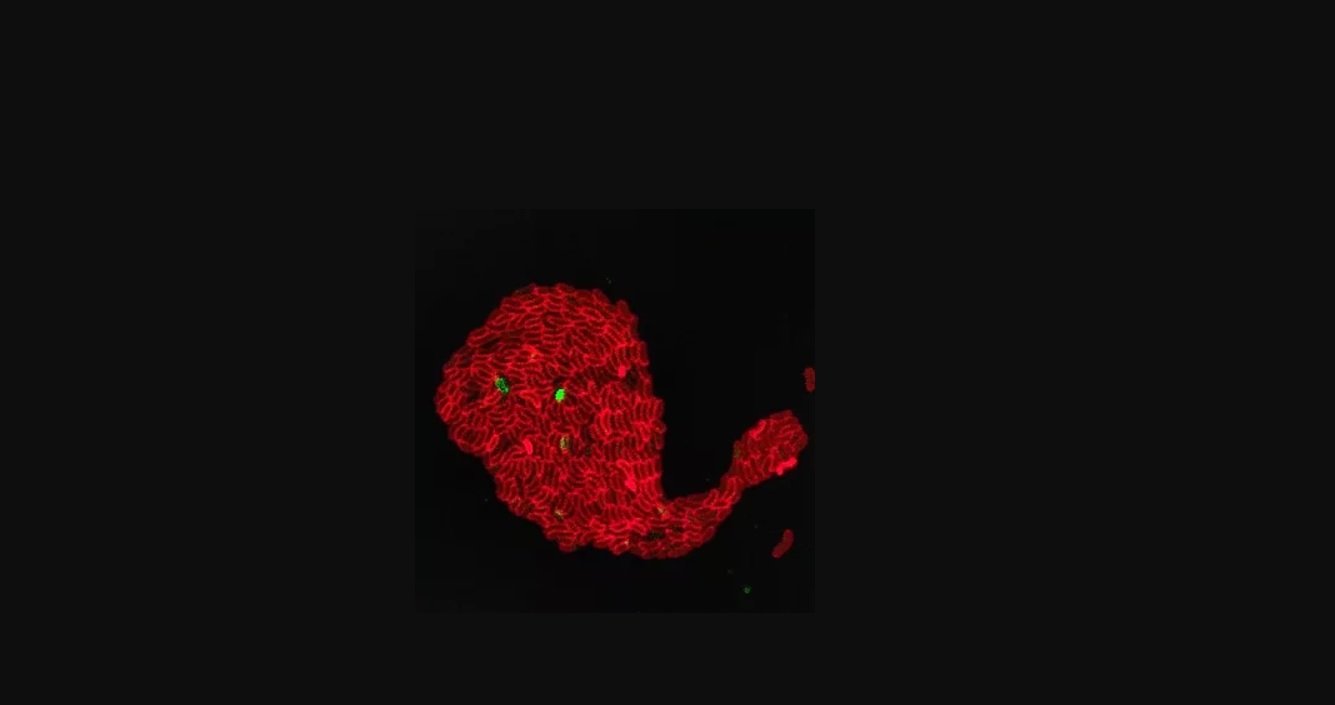 microscopía confocal, una técnica para incrementar el contraste y reconstruir imágenes tridimensionales