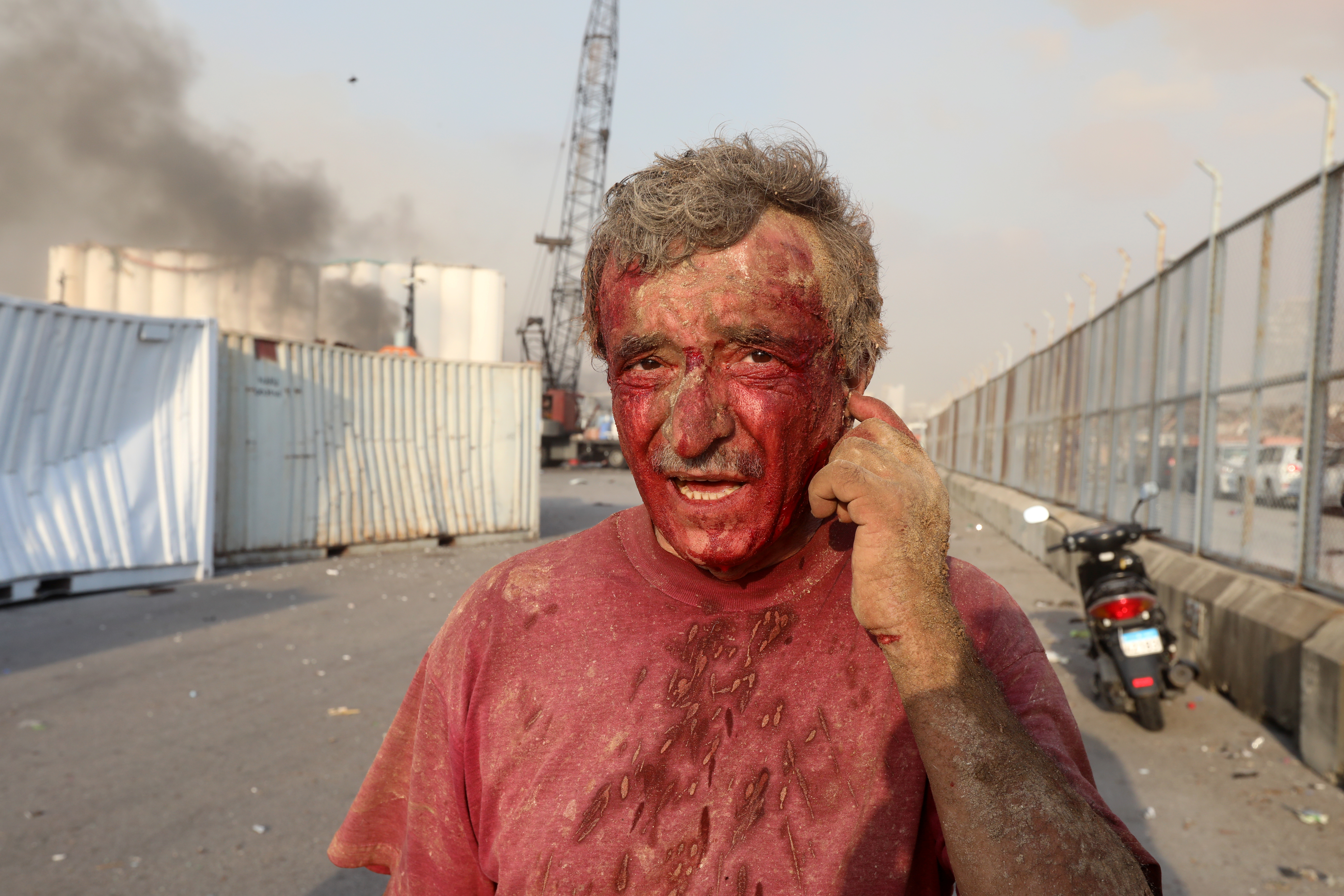 Un hombre herido después de las explosiones en Beirut (Reuters/ Mohamed Azakir)