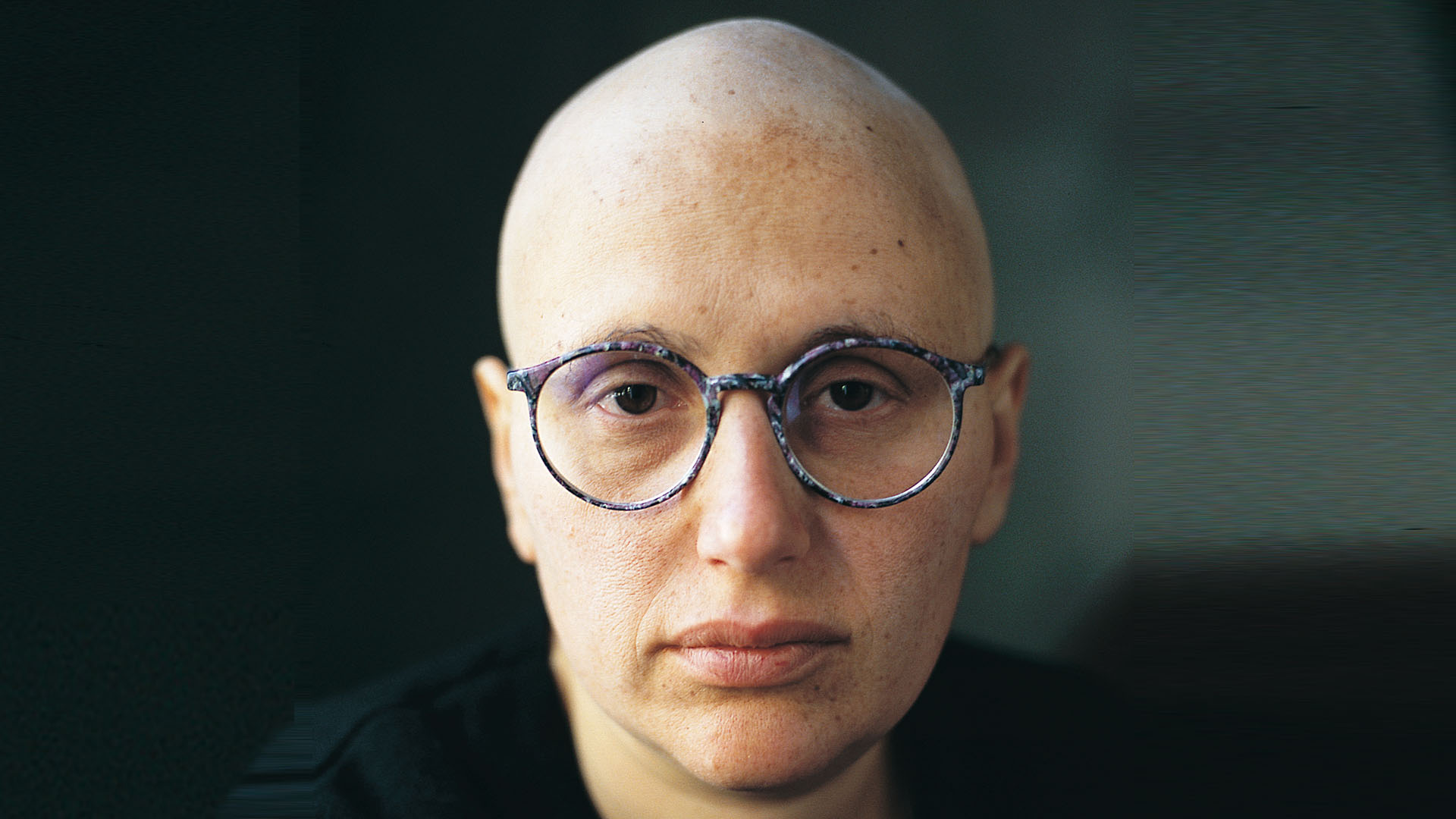 Tiempos difíciles. Patricia Kolesnicov y los efectos visibles de la quimioterapia.
