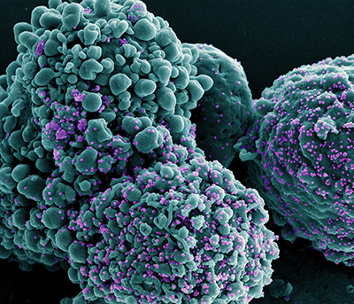 Célula infectada con el coronavirus ómicron (en violeta), observada en un microscopio electrónico (National Institute of Allergy and Infectious Diseases)