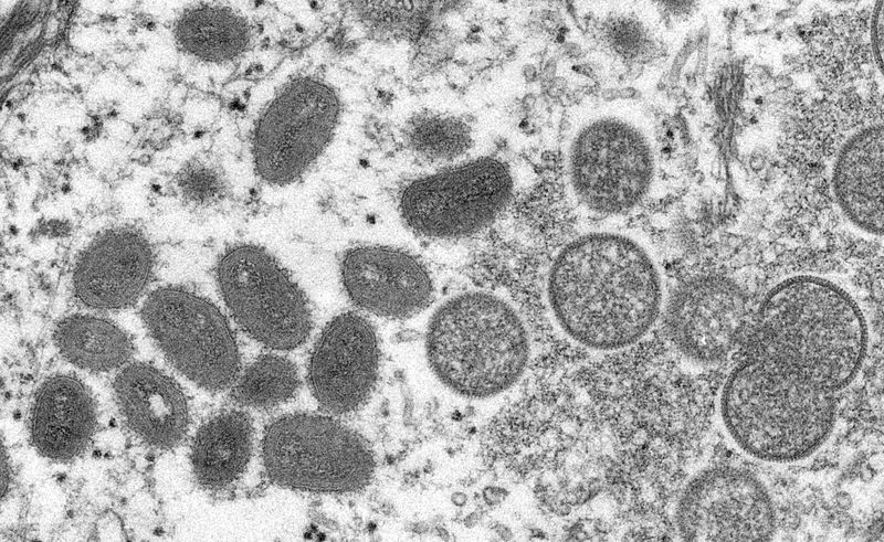 Una imagen de microscopio electrónico (EM) muestra partículas maduras del virus de la viruela del mono, de forma ovalada, así como semilunas y partículas esféricas de viriones inmaduros, obtenidas de una muestra clínica de piel humana asociada al brote de perritos de la pradera de 2003, en esta imagen sin fecha obtenida por Reuters el 18 de mayo de 2022. Cynthia S. Goldsmith, Russell Regnery/CDC/Handout vía REUTERS