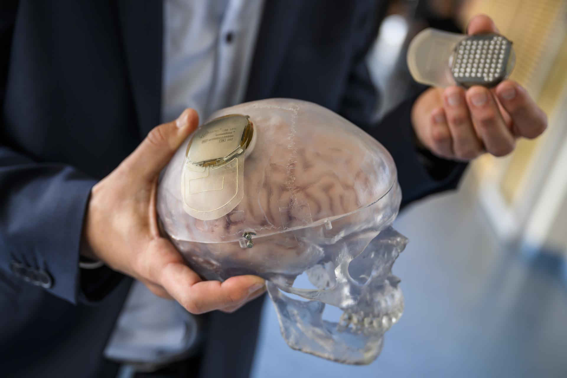 La nueva interfaz es capaz de "registrar la actividad cerebral en la superficie del córtex", explicó el investigador Guillaume Charvet, del Comisariado de Energía Atómica, institución francesa que ha trabajado en el proyecto junto al CHUV en el estudio (EFE)
