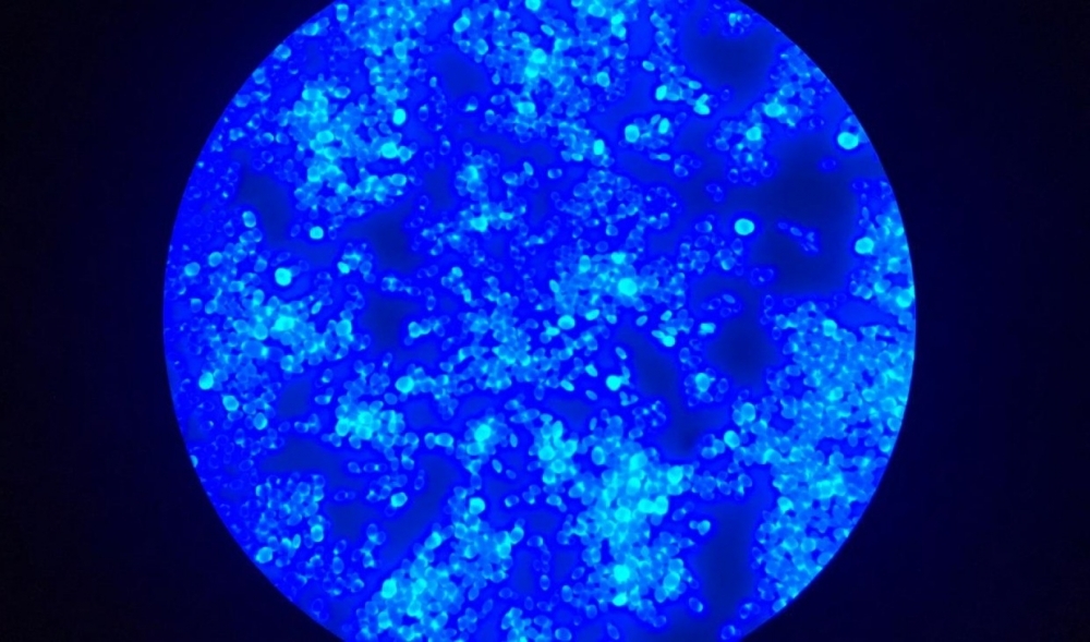 Los CDC lanzaron una alerta por la alta contagiosidad del Candida auris