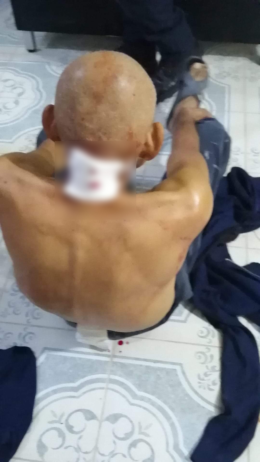 Elementos de la SEMEFO ya revisaron las heridas (Foto: Facebook/Jaime Vargas)